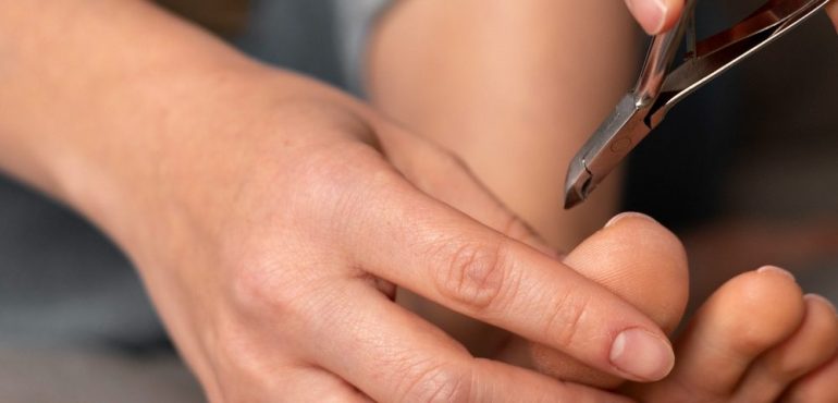 how-to-stop-small-foot-issues-from-turning-into-big-problems.