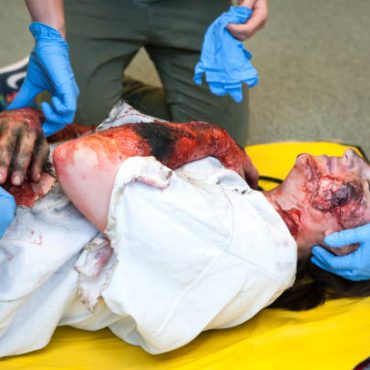 the-long-term-costs-of-skin-grafting-and-reconstructive-surgery-after-thermal-trauma.