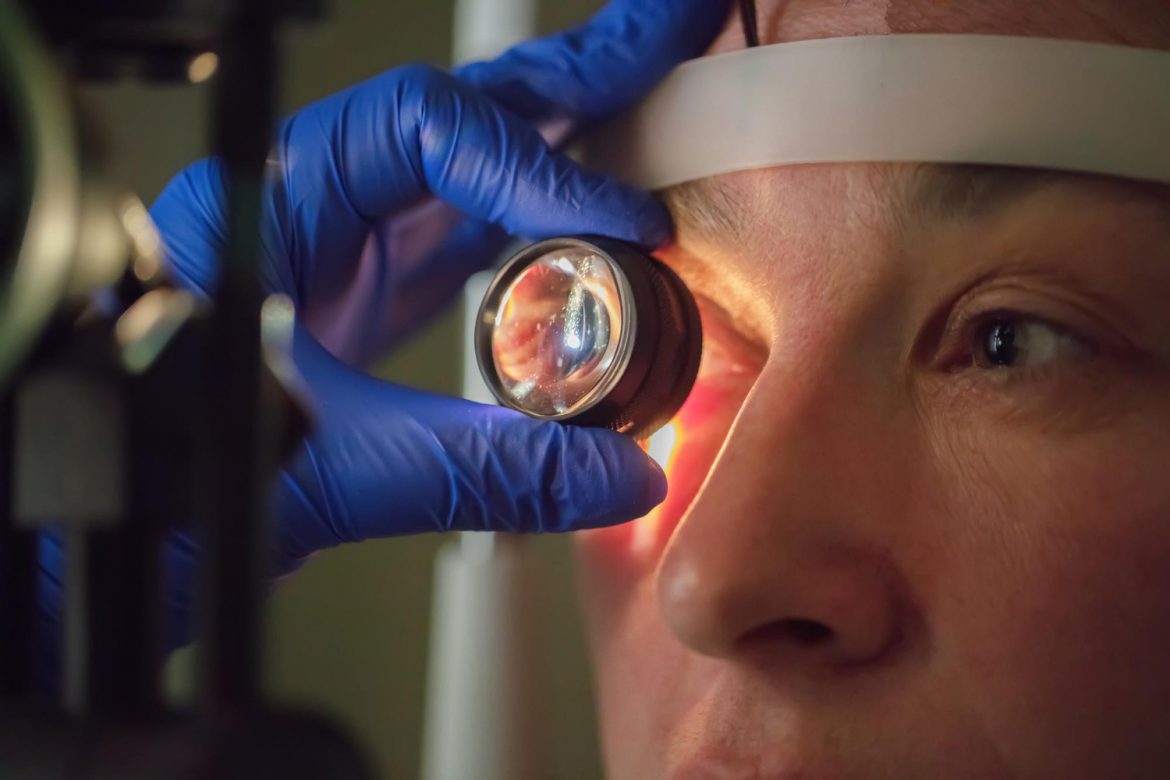 how-to-find-the-best-eye-clinic-in-london-for-vision-correction.