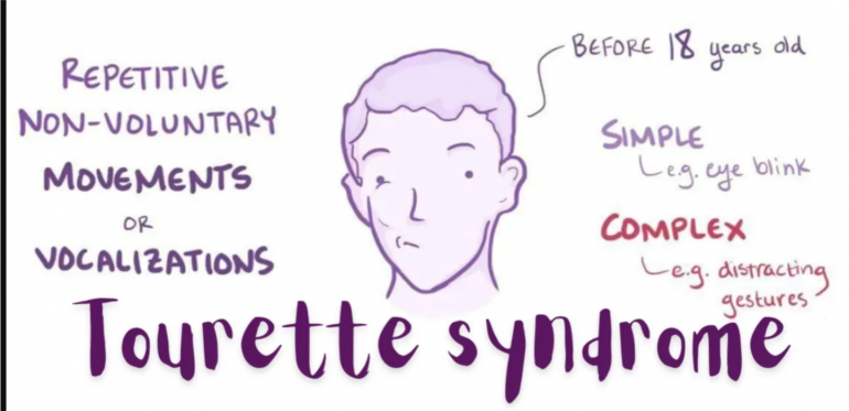 what-is-tourette-syndrome?-symptoms,-causes,-history-and-treatment-(2026-guide).